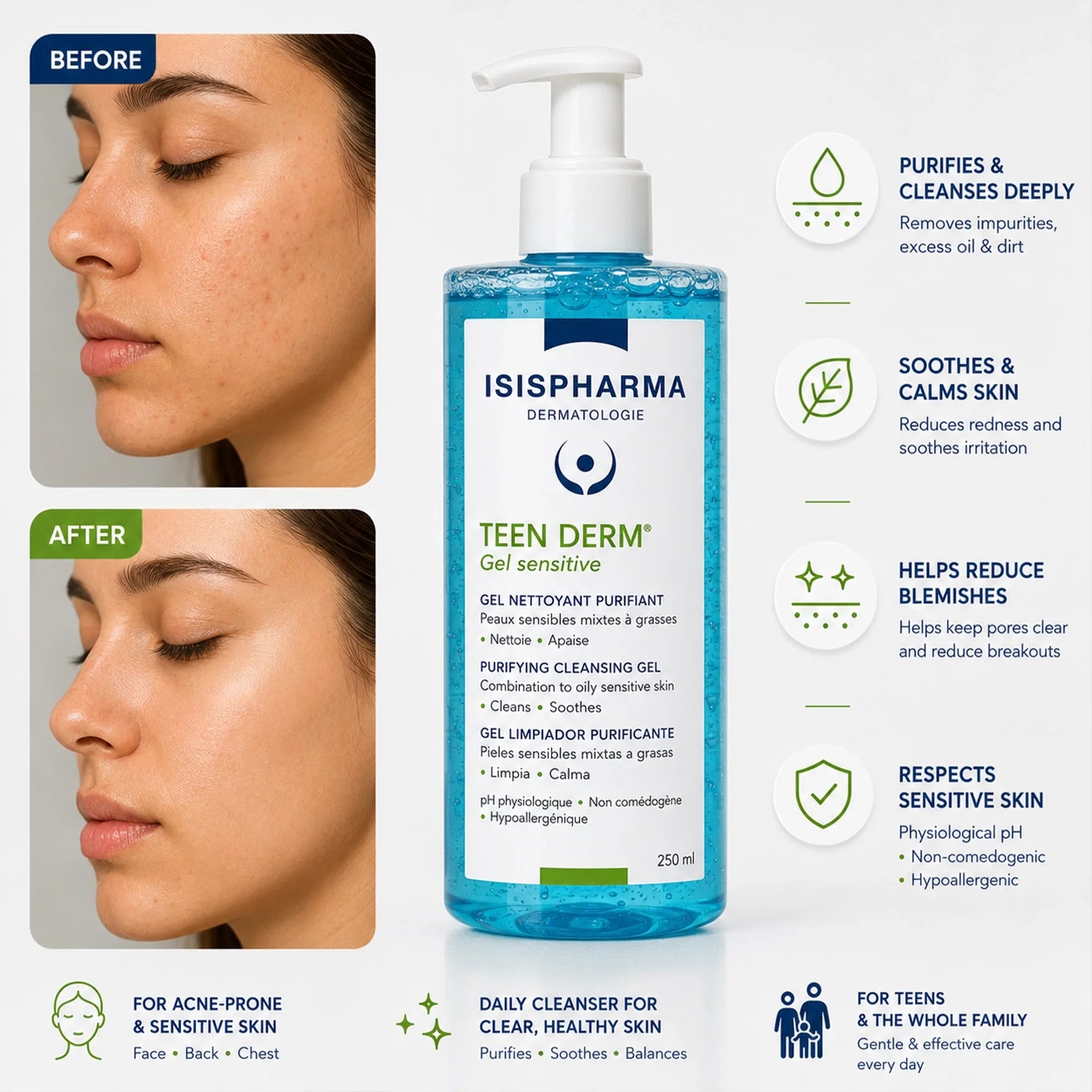 ISISPHARMA Teen Derm Gel Sensitive – 250ml